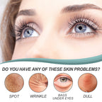EELHOE Dark Spot Corrector